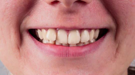 orthodontic treatment basingstoke orthodontics