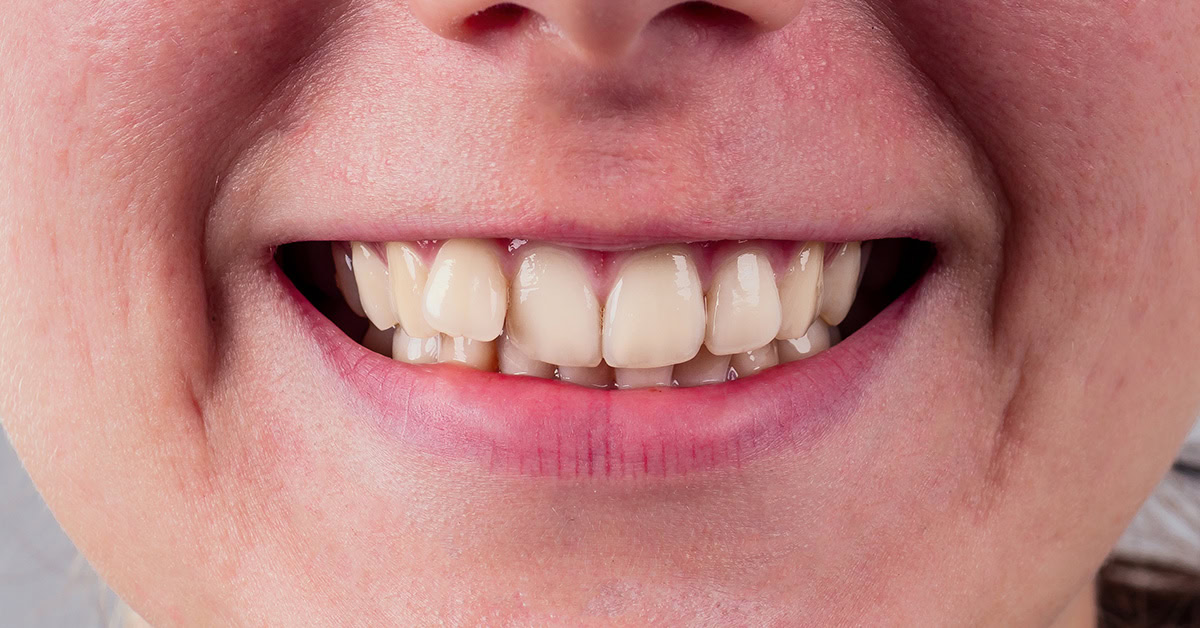 orthodontic treatment basingstoke orthodontics